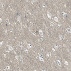 Anti-HTR1F Antibody