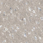 Anti-HTR1F Antibody