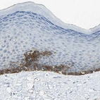 Immunohistochemical staining of human skin shows strong cytoplasmic positivity in basal cells.