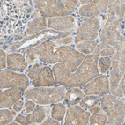 Anti-HTR1F Antibody