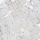 Immunohistochemical staining of human skeletal muscle shows no positivity in myocytes as expected.