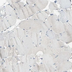 Immunohistochemical staining of human skeletal muscle shows no positivity in myocytes as expected.