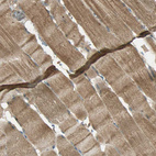Immunohistochemical staining of human skeletal muscle shows moderate cytoplasmic positivity in myocytes.