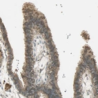 Immunohistochemical staining of human Fallopian tube shows moderate cytoplasmic positivity in glandular cells.