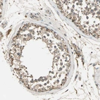 Immunohistochemical staining of human testis shows weak cytoplasmic positivity in cells in seminiferous ducts.