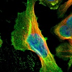 Immunofluorescent staining of human cell line U-2 OS shows localization to nucleoplasm, plasma membrane & cytosol.