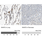 Anti-SKAP2 Antibody