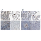 Immunohistochemical staining of human duodenum, lung, lymph node and pancreas using Anti-SKAP2 antibody HPA005560 (A) shows similar protein distribution across tissues to independent antibody HPA024045 (B).