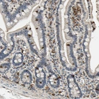 Immunohistochemical staining of human duodenum shows moderate cytoplasmic positivity in lymphoid cells.
