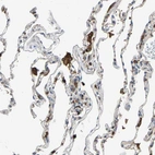 Immunohistochemical staining of human lung shows strong cytoplasmic positivity in macrophages.