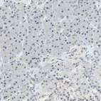 Anti-SKAP2 Antibody