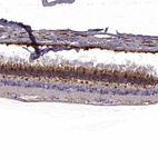 Anti-GUCA1A Antibody