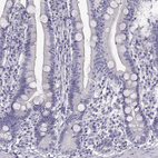 Immunohistochemical staining of human duodenum shows no positivity in glandular cells as expected.