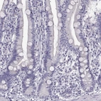 Immunohistochemical staining of human duodenum shows no positivity in glandular cells as expected.