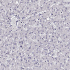 Anti-GUCA1A Antibody