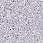 Immunohistochemical staining of human liver shows no positivity in hepatocytes as expected.