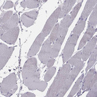Immunohistochemical staining of human skeletal muscle shows no positivity in myocytes as expected.