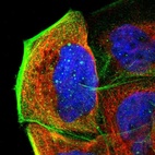 Immunofluorescent staining of human cell line A-431 shows localization to cytosol & actin filaments.