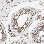 Anti-PCSK4 Antibody