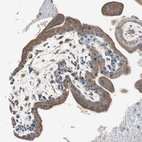 Immunohistochemical staining of human placenta shows moderate granular cytoplasmic positivity in trophoblastic cells.