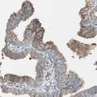Immunohistochemical staining of human fallopian tube shows moderate granular cytoplasmic positivity in glandular cells.