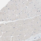 Immunohistochemical staining of human skeletal muscle shows no positivity in myocytes as expected.