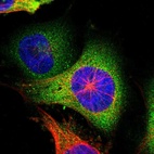 Immunofluorescent staining of human cell line U-251 MG shows localization to cytosol.