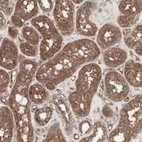 Immunohistochemical staining of human kidney shows strong cytoplasmic positivity in cells in tubules.