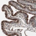 Immunohistochemical staining of human fallopian tube shows strong cytoplasmic positivity in glandular cells.
