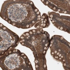 Immunohistochemical staining of human small intestine shows strong cytoplasmic positivity in glandular cells.