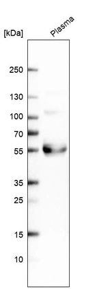 Western blot analysis in human plasma.