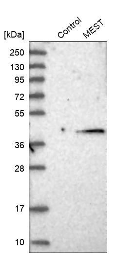 Anti-MEST Antibody