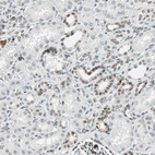 Immunohistochemical staining of human kidney shows nuclear positivity in cells in tubules.