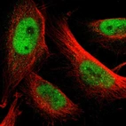 Immunofluorescent staining of human cell line U-251 MG shows localization to nucleoplasm.