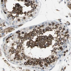 Immunohistochemical staining of human testis shows strong granular cytoplasmic positivity in cells in seminiferous ducts.