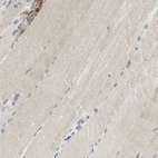 Immunohistochemical staining of human skeletal muscle shows weak granular cytoplasmic positivity in myocytes.