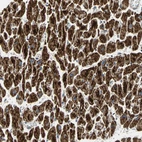 Immunohistochemical staining of human heart muscle shows strong positivity in mitochondria in cardiomyocytes.