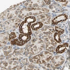 Immunohistochemical staining of human kidney shows strong positivity in mitochondria in cells in tubules.