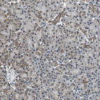 Anti-NDUFB5 Antibody