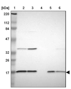 Lane 1: Marker [kDa] 220, 112, 84, 47, 32, 26, 17_br/_Lane 2: Human cell line RT-4_br/_Lane 3: Human cell line U-251MG sp_br/_Lane 4: Human plasma (IgG/HSA depleted)_br/_Lane 5: Human liver tissue_br/_Lane 6: Human tonsil tissue