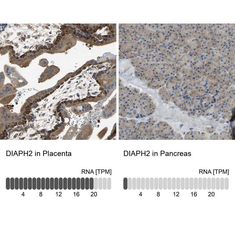 Anti-DIAPH2 Antibody