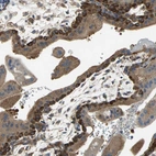Immunohistochemical staining of human placenta shows high expression.