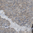 Anti-DIAPH2 Antibody