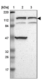 Lane 1: Marker [kDa] 220, 112, 84, 47, 32, 26, 17_br/_Lane 2: Human cell line RT-4_br/_Lane 3: Human cell line U-251MG sp