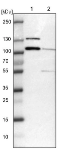 Lane 1: NIH-3T3 cell lysate (Mouse embryonic fibroblast cells)_br/_Lane 2: NBT-II cell lysate (Rat Wistar bladder tumour cells)