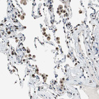 Anti-MAFB Antibody