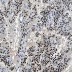 Immunohistochemical staining of human parathyroid gland shows moderate to strong nuclear positivity in glandular cells.