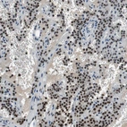 Immunohistochemical staining of human parathyroid gland shows moderate to strong nuclear positivity in glandular cells.