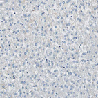 Immunohistochemical staining of human liver shows no positivity in hepatocytes as expected.