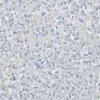Immunohistochemical staining of human liver shows no positivity in hepatocytes as expected.